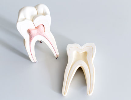 根管治療／歯内療法